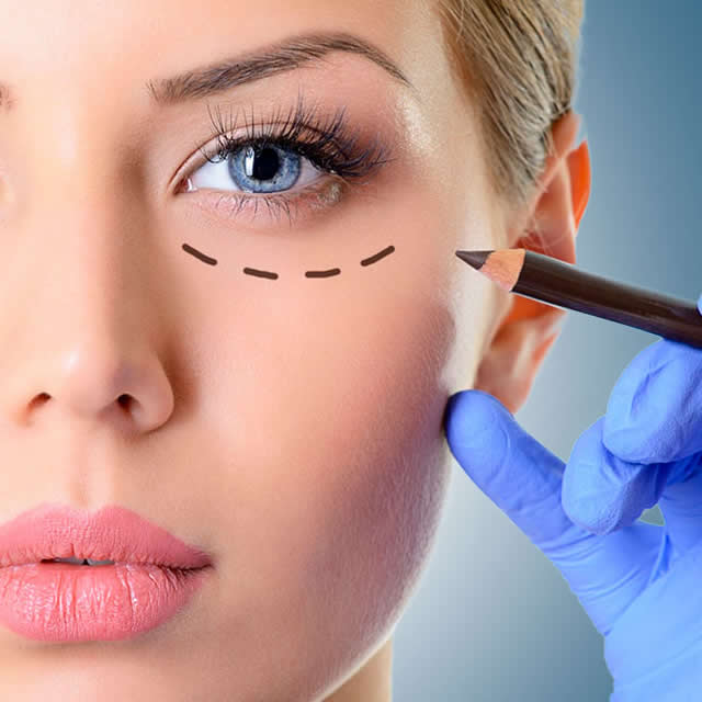 RINOPLASTIA-ULTRASONICA-GUAYAQUIL